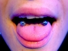 nicoletta-snake-bites-2007.jpg