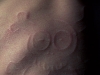 anna-skull-healed-3-2007.jpg