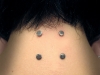 double-nape-2009.jpg