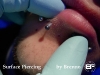 labret-surface-exposed.jpg