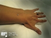 surfacemicrodermal